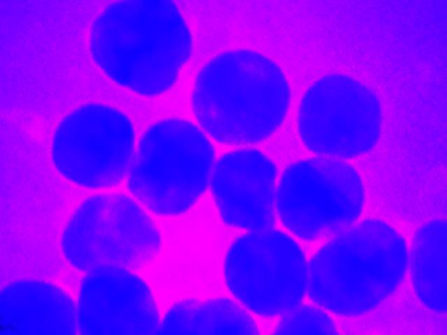 Image of silver nanoparticles from Korin Wheelers lab taken with a transmission electron microscope and modified by Takeshi Moro.